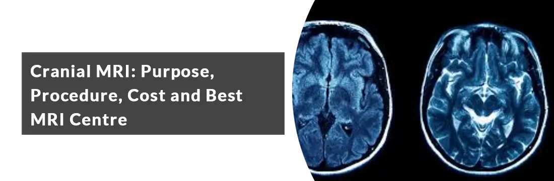  Cranial MRI: Purpose, Procedure, Cost and Best MRI Centre